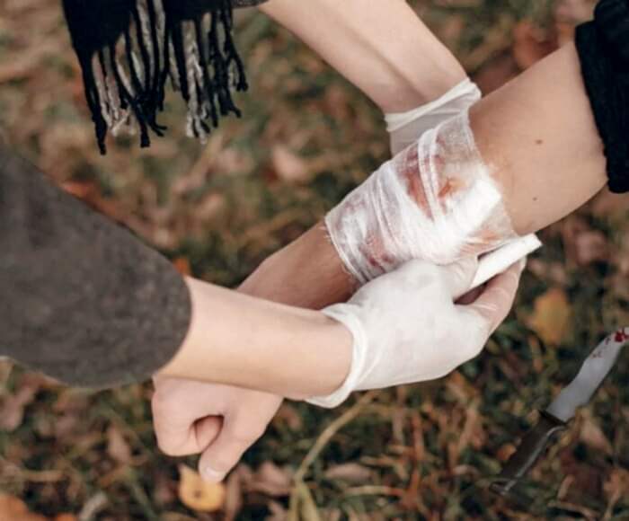 kasten yaralama suçunda yaralının elinin sarılması